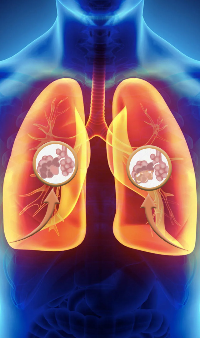 या गोष्टी खाल्ल्याने जास्त श्लेष्मा निर्माण होतो