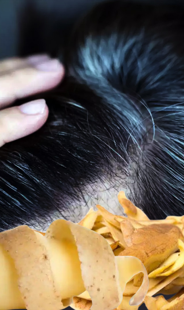 बटाट्याच्या सालीने पांढरे केस काळे करा