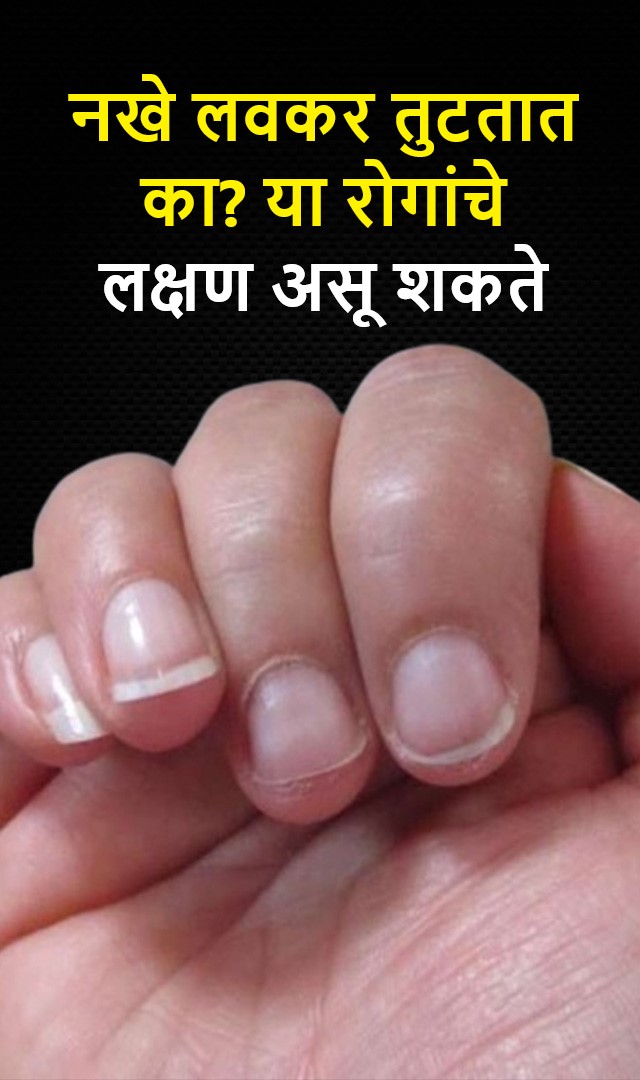 नखे लवकर का तुटतात ? या रोगांचे लक्षण असू शकते