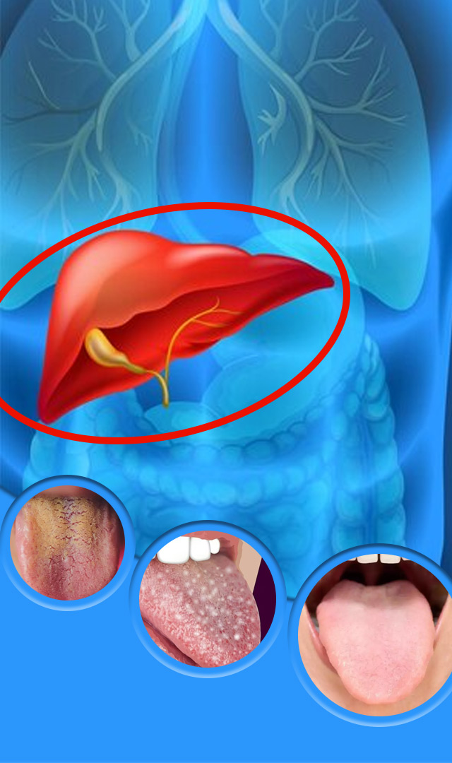 जिभेची ही लक्षणे लिव्हरचे नुकसान दर्शवतात