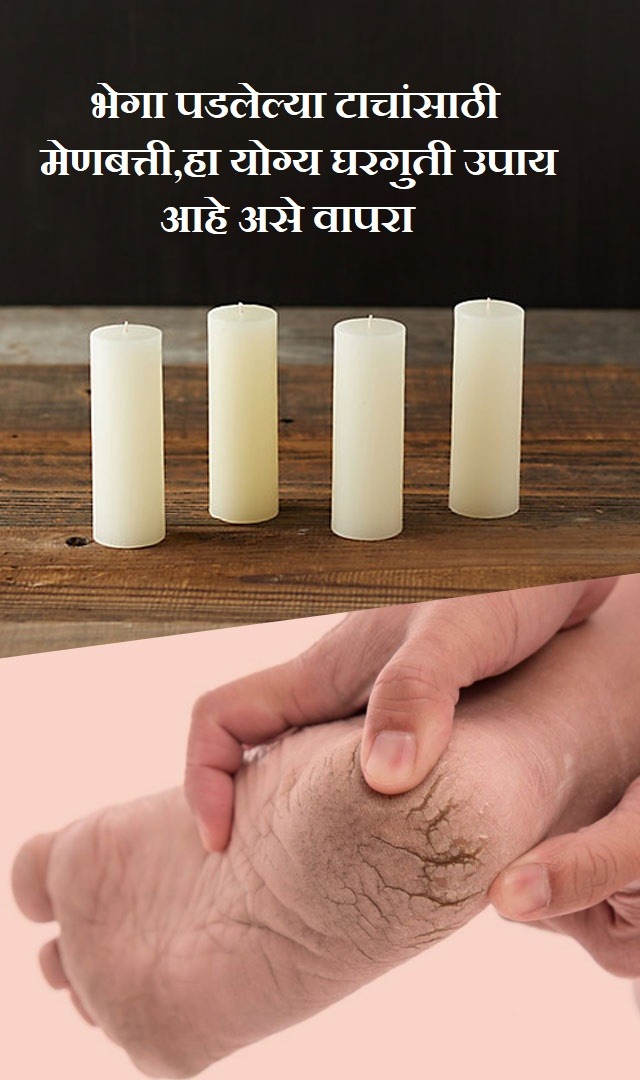 मेणबत्ती हा भेगा पडलेल्या टाचांसाठी योग्य घरगुती उपाय आहे, असे वापरा