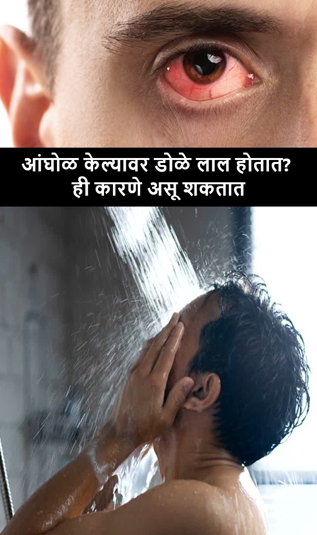 आंघोळ केल्यावर डोळे लाल होतात? ही कारणे असू शकतात