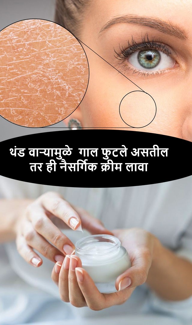 थंड वाऱ्यामुळे तुमचे गाल फुटले असतील तर ही नैसर्गिक क्रीम लावा