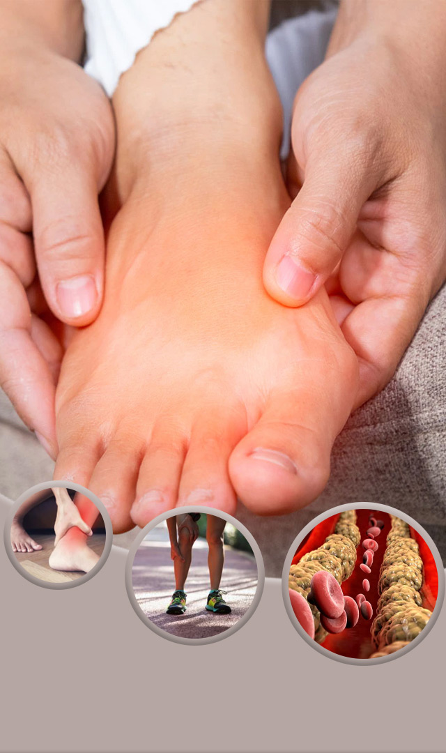   उच्च कोलेस्टेरॉल पातळीची ही लक्षणे बोटांमध्ये दिसतात