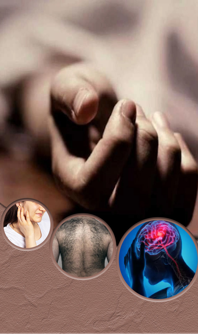 Mysterious Disease माणूस स्वतःला मृत समजतो, जाणून घ्या 5 विचित्र आजारांबद्दल