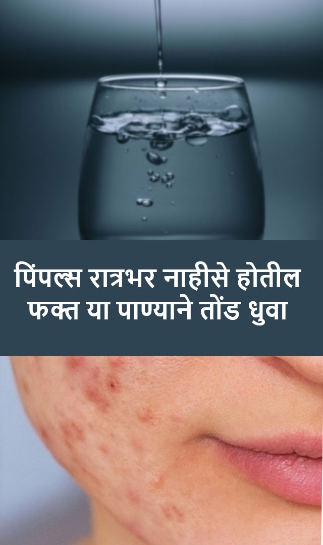 पिंपल्स रात्रभर नाहीसे होतील, फक्त या पाण्याने तोंड धुवा.