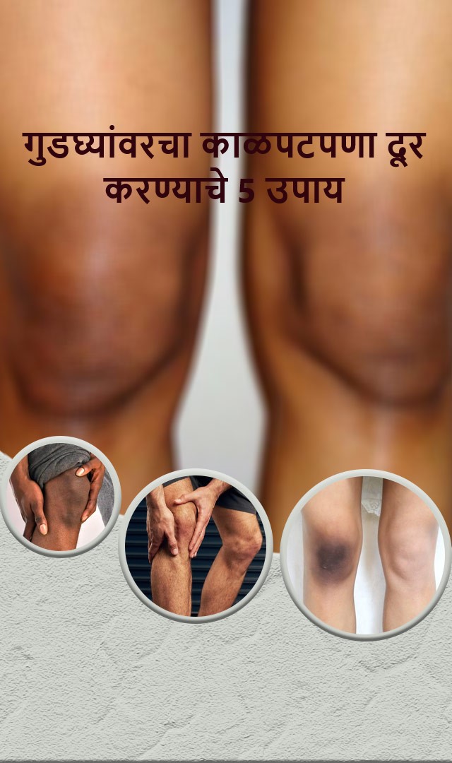 गुडघ्यांवरचा काळपटपणा दूर करण्याचे 5 उपाय 
