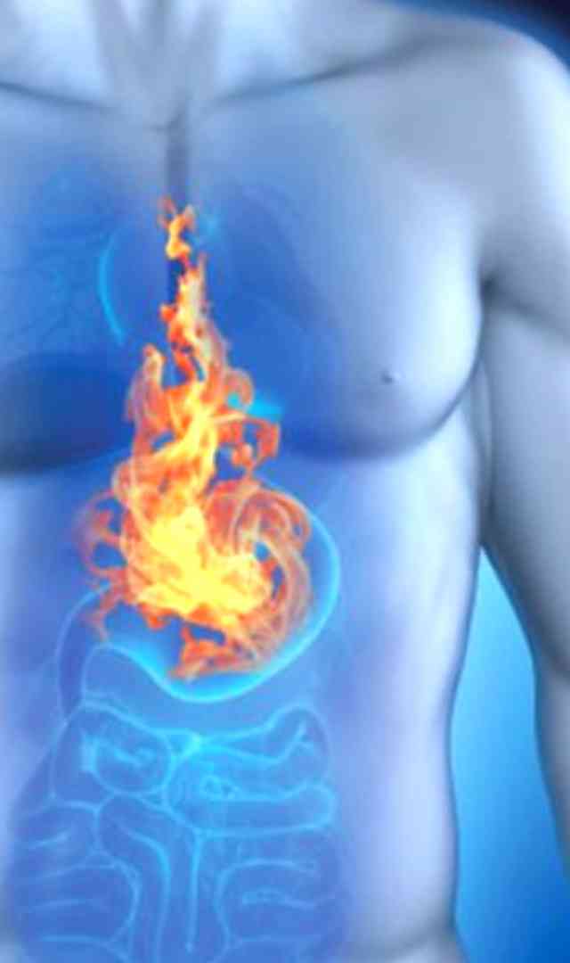 Acidity కడుపులో మంట తగ్గించుకునేందుకు చిట్కాలు