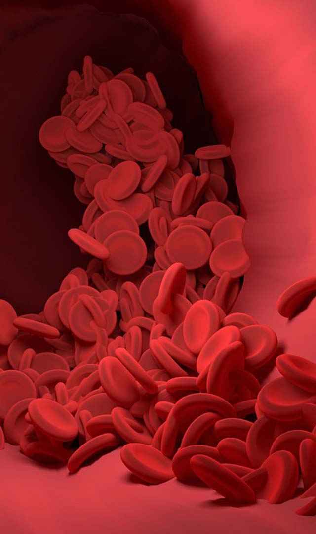 Blood Clots, రక్తం గడ్డకట్టే ఆహారాలు ఏమిటి?