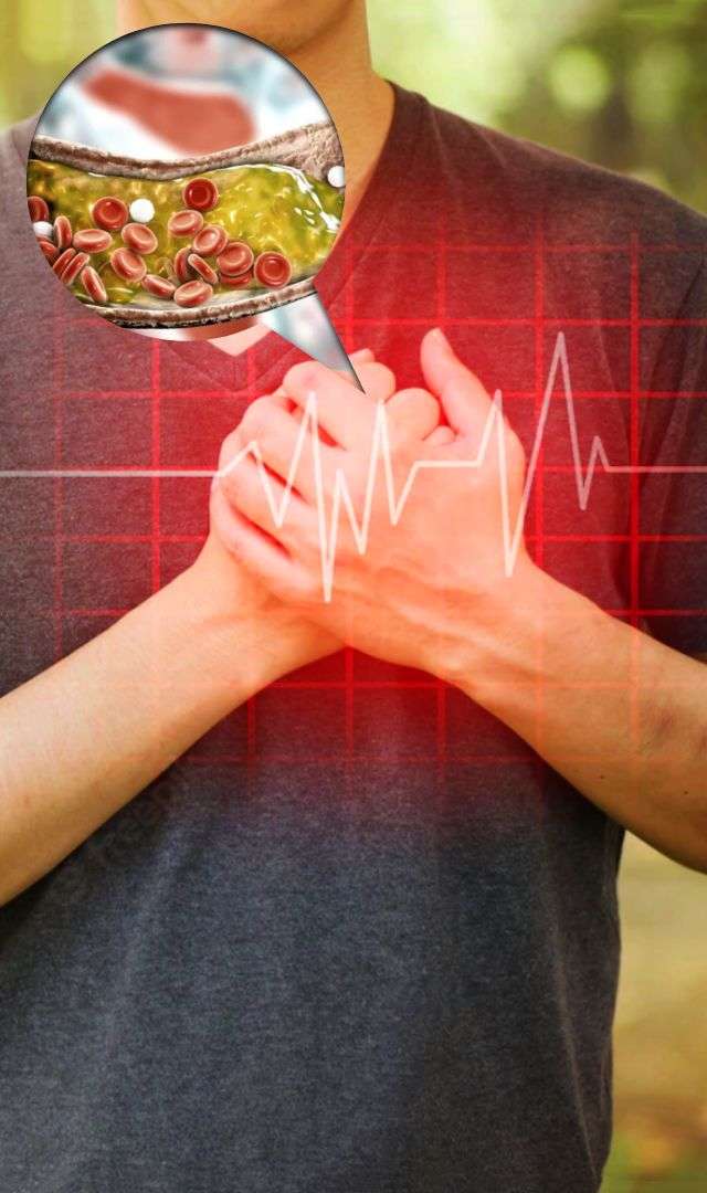 గుండె జబ్బులకు కారణమయ్యే చెడు కొలెస్ట్రాల్‌ తగ్గించుకునేదెలా?